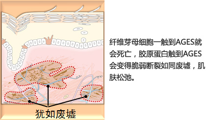 当前图片注释